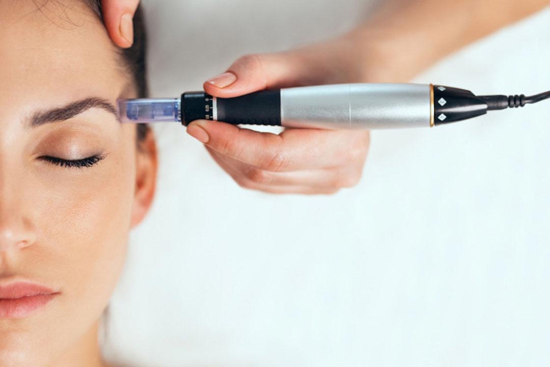 Microneedling 101: Tiny Needles, BIG Results
